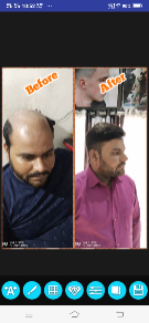 Rockstar-Salon-Hair-Wig-and-Patch-Center-In-Mandsaur